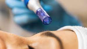 Dermapen for fine lines