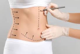 Say goodbye to excess fat