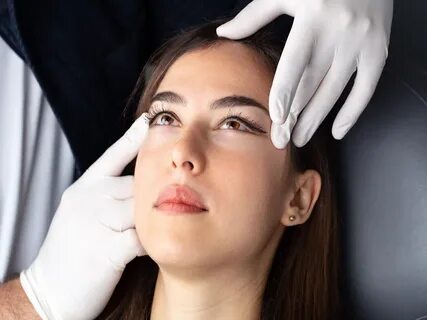 Eyelid Surgery A Complete Guide to Transform Your Look